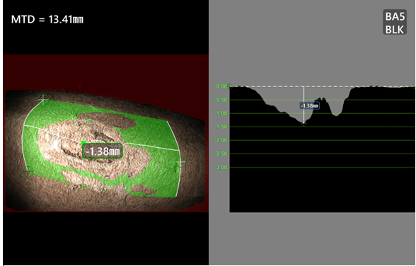 韋林視頻內窺鏡深度剖面測量示意圖 韋林視頻內窺鏡深度剖面測量示意圖