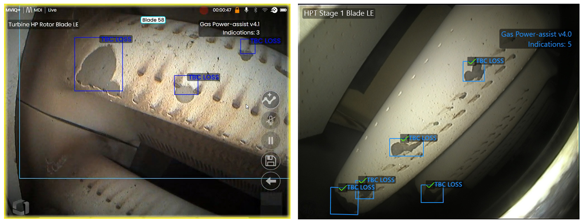 ADR人工智能輔助缺陷識別系統(tǒng)識別缺陷及葉片智能計數(shù)功能 ADR人工智能輔助缺陷識別系統(tǒng)識別缺陷及葉片智能計數(shù)功能